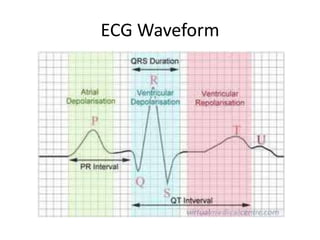 ECG Waveform
 
