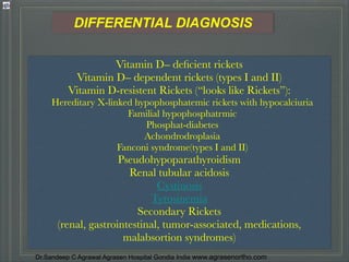 Table Rickets Differential Understanding rickets types,diagnosis,prevention & treatment dr.sandeep ...