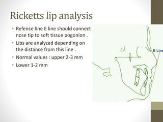 Ricketts Line Understanding soft tissues | PPTX