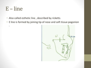 Understanding soft tissues | PPTX