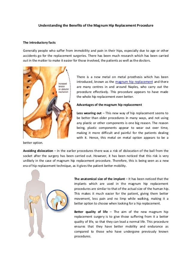 Understanding the benefits of the magnum hip replacement procedure