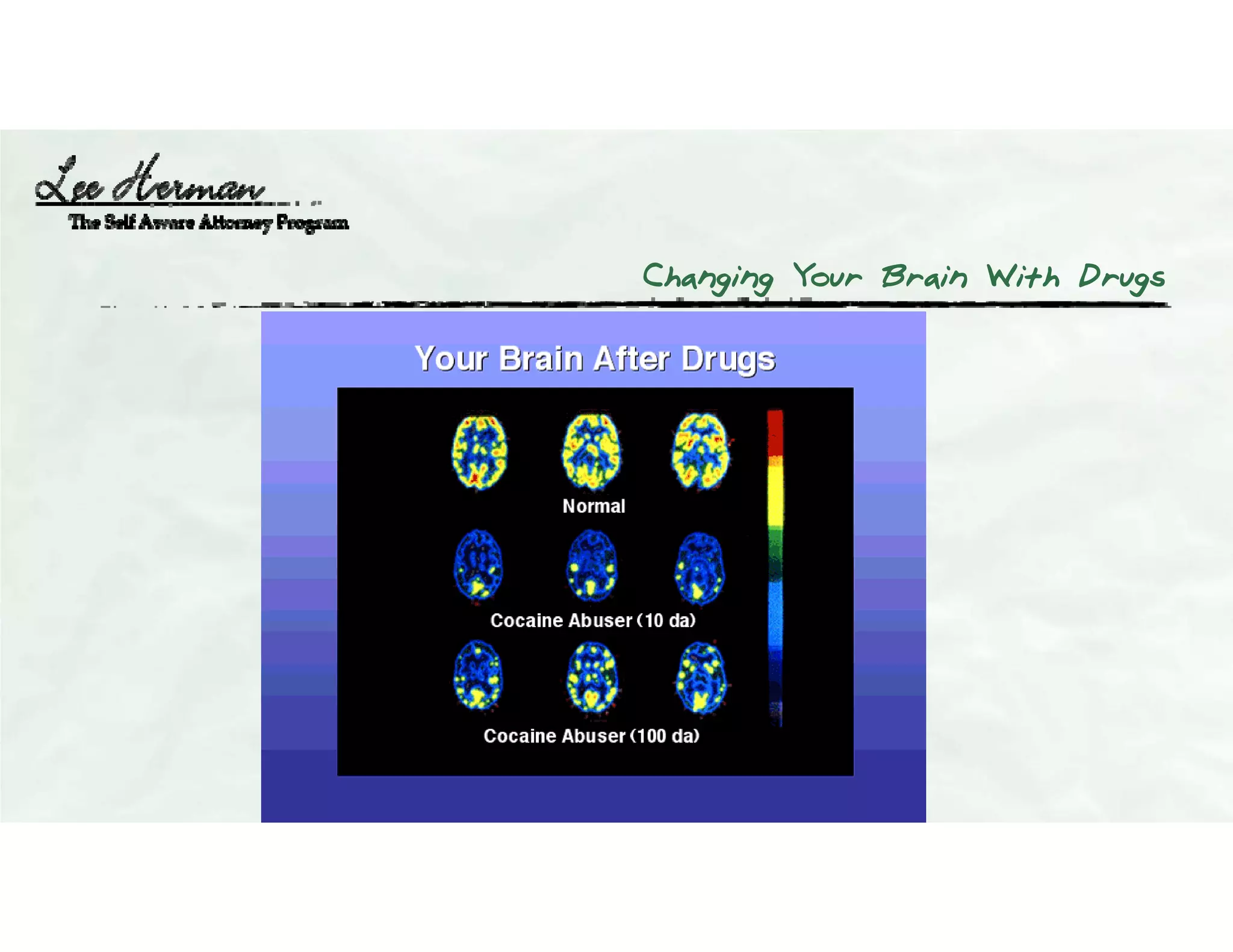 Changing Your Brain With Drugs
 