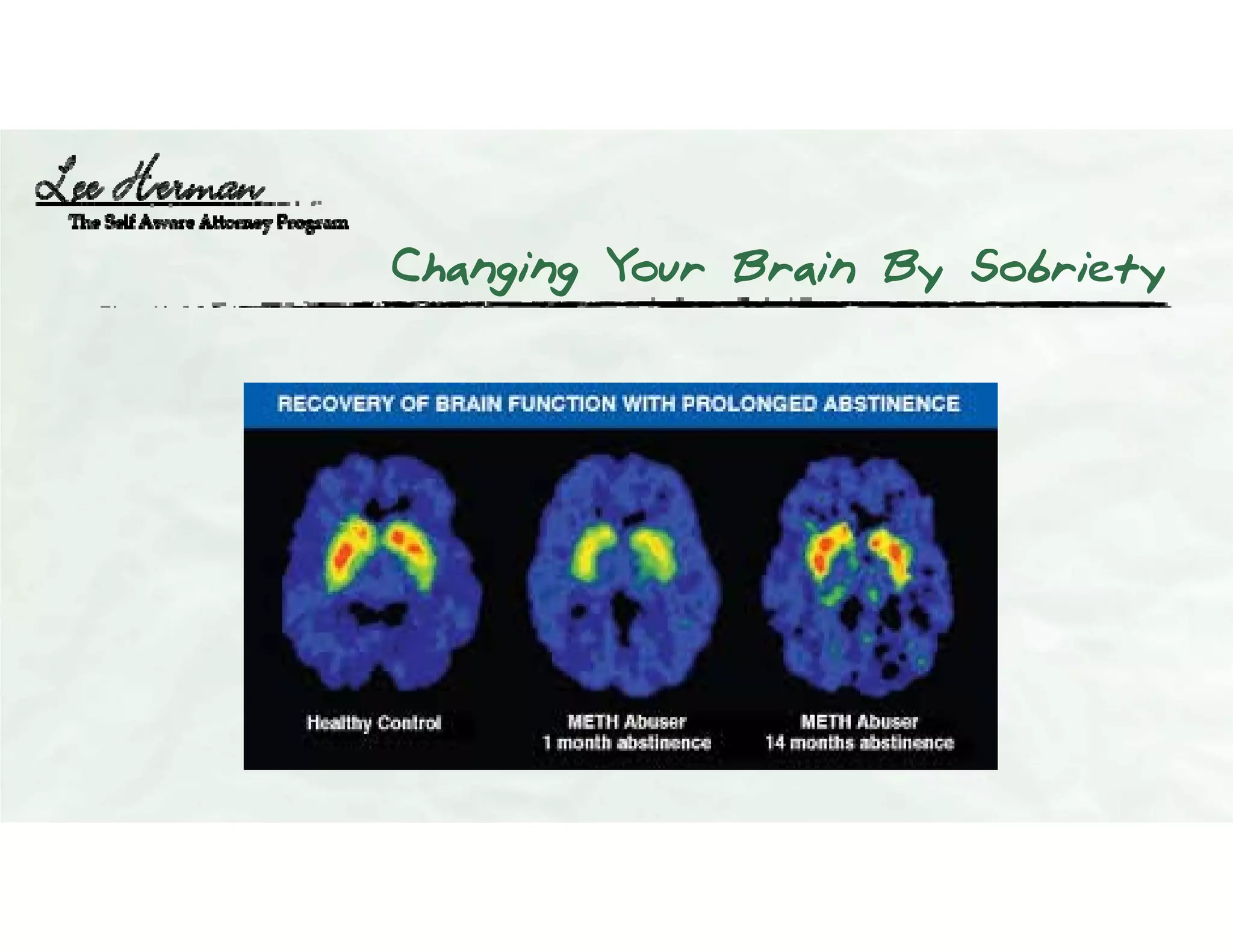 Changing Your Brain By Sobriety
 