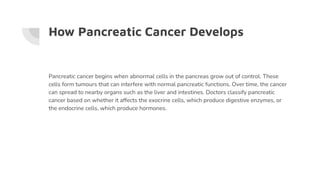 Understanding the Causes and Treatment of Pancreatic Cancer | PDF