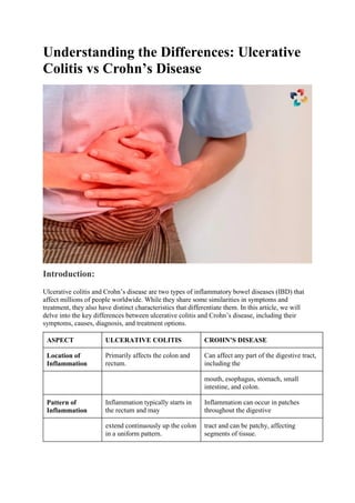Understanding the Differences: Ulcerative
Colitis vs Crohn’s Disease
Introduction:
Ulcerative colitis and Crohn’s disease are two types of inflammatory bowel diseases (IBD) that
affect millions of people worldwide. While they share some similarities in symptoms and
treatment, they also have distinct characteristics that differentiate them. In this article, we will
delve into the key differences between ulcerative colitis and Crohn’s disease, including their
symptoms, causes, diagnosis, and treatment options.
ASPECT ULCERATIVE COLITIS CROHN’S DISEASE
Location of
Inflammation
Primarily affects the colon and
rectum.
Can affect any part of the digestive tract,
including the
mouth, esophagus, stomach, small
intestine, and colon.
Pattern of
Inflammation
Inflammation typically starts in
the rectum and may
Inflammation can occur in patches
throughout the digestive
extend continuously up the colon
in a uniform pattern.
tract and can be patchy, affecting
segments of tissue.
 