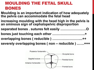 MOULDING THE FETAL SKULL
BONES
Moulding is an important indication of how adequately
the pelvis can accommodate the fetal head
increasing moulding with the head high in the pelvis is
an ominous sign of cephalopelvic disproportion
separated bones . sutures felt easily ……………….….O
bones just touching each other ………………………..+
overlapping bones ( reducible ) ……………………...++
severely overlapping bones ( non – reducible ) ..…..+++
 