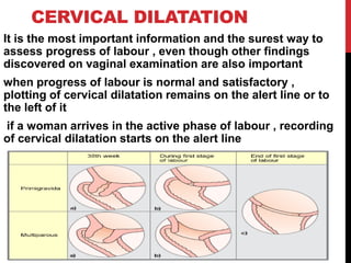 CERVICAL DILATATION
It is the most important information and the surest way to
assess progress of labour , even though other findings
discovered on vaginal examination are also important
when progress of labour is normal and satisfactory ,
plotting of cervical dilatation remains on the alert line or to
the left of it
if a woman arrives in the active phase of labour , recording
of cervical dilatation starts on the alert line
 