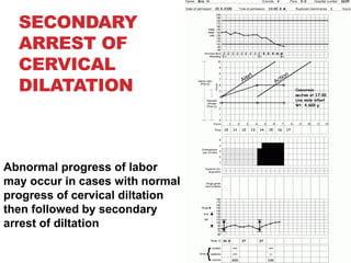 SECONDARY
ARREST OF
CERVICAL
DILATATION
Abnormal progress of labor
may occur in cases with normal
progress of cervical diltation
then followed by secondary
arrest of diltation
 
