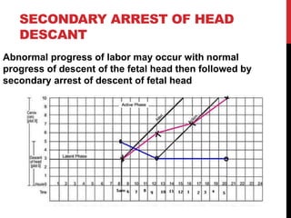 SECONDARY ARREST OF HEAD
DESCANT
Abnormal progress of labor may occur with normal
progress of descent of the fetal head then followed by
secondary arrest of descent of fetal head
 