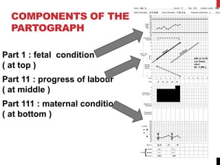 COMPONENTS OF THE
PARTOGRAPH
Part 1 : fetal condition
( at top )
Part 11 : progress of labour
( at middle )
Part 111 : maternal condition
( at bottom )
 