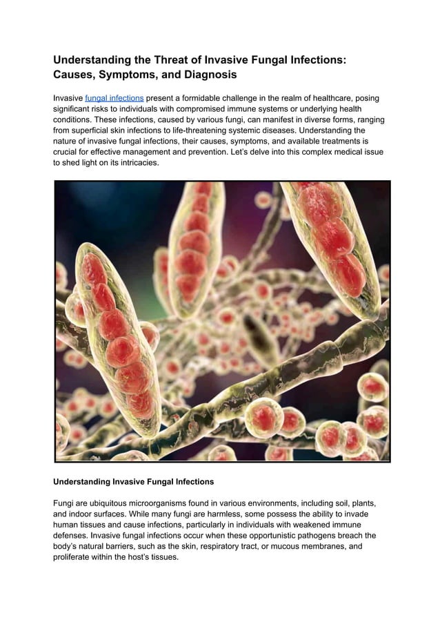 Fungal Infections Causes And Diagnoses – DQTQ