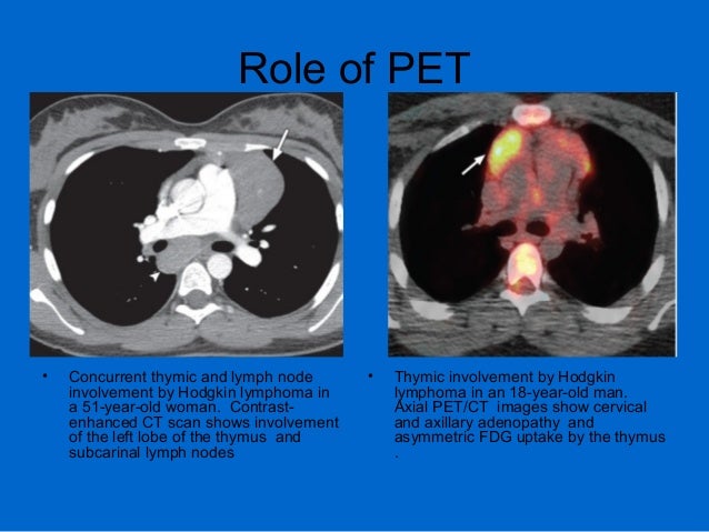 Understanding the thymus