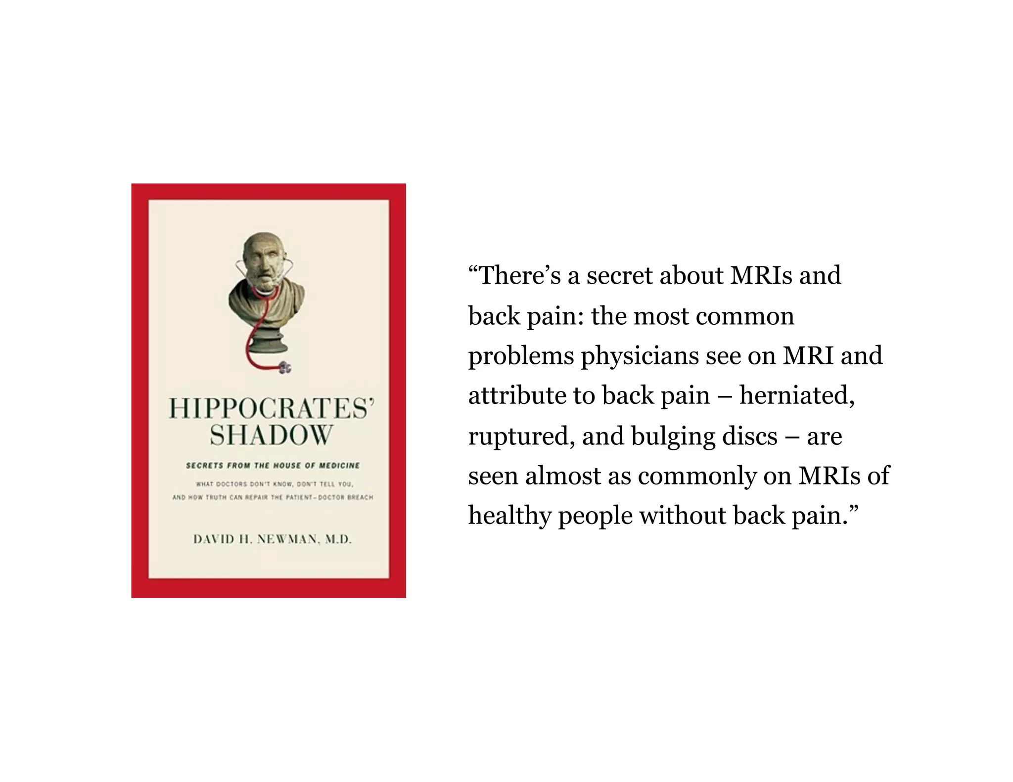 “There’s a secret about MRIs and
back pain: the most common
problems physicians see on MRI and
attribute to back pain – herniated,
ruptured, and bulging discs – are
seen almost as commonly on MRIs of
healthy people without back pain.”
 