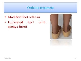 Orthotic treatment
• Modified foot orthosis
• Excavated heel with
sponge insert
6/21/2021 25
 