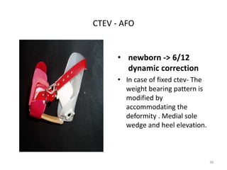 CTEV - AFO
• newborn -> 6/12
dynamic correction
• In case of fixed ctev- The
weight bearing pattern is
modified by
accommodating the
deformity . Medial sole
wedge and heel elevation.
38
 