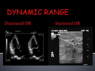 Understanding ultrasound Slide 19