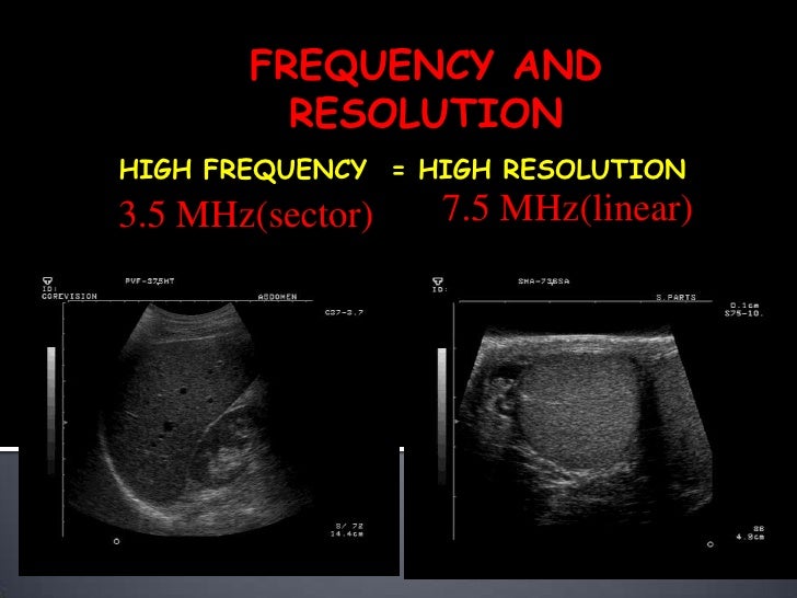 Understanding ultrasound