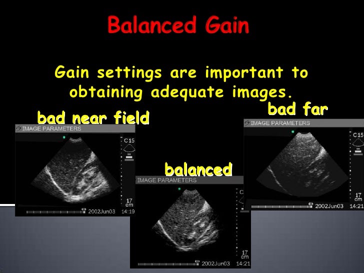 Understanding ultrasound