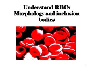 Bizzare Rbcs Understand RBCs morphology and inclusion bodies.ppt