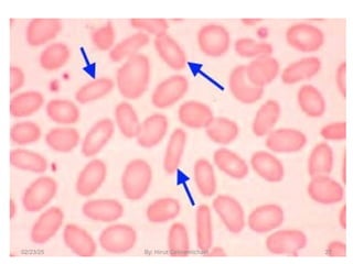 Protruding Rbcs Understand RBCs morphology and inclusion bodies.ppt