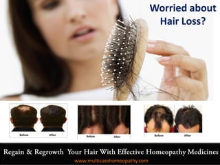 Worried about
Hair Loss?
www.multicarehomeopathy.com
 