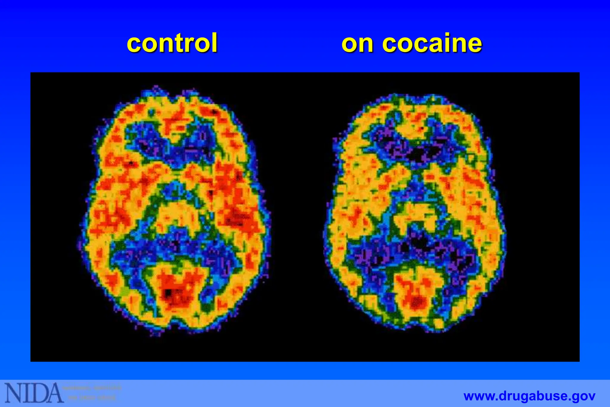 control on cocaine
www.drugabuse.gov
 