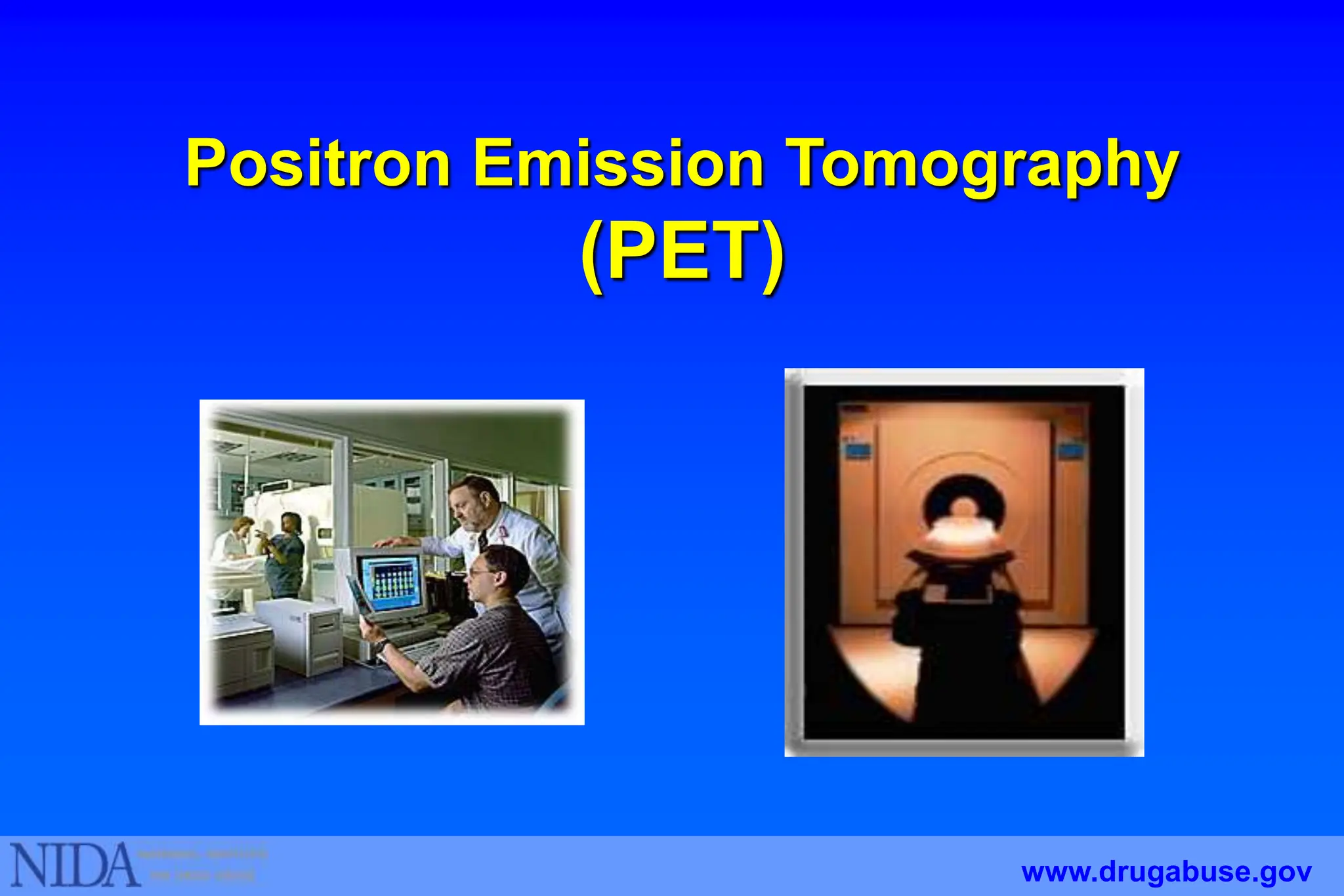 Positron Emission Tomography
(PET)
www.drugabuse.gov
 