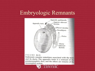 Embryologic Remnants
 