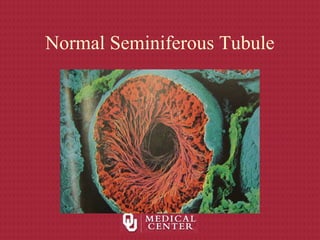 Normal Seminiferous Tubule
 