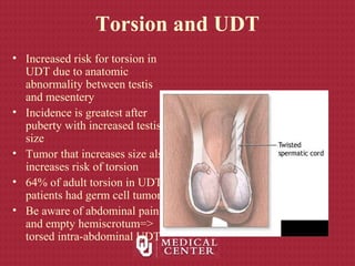 Torsion and UDT
• Increased risk for torsion in
UDT due to anatomic
abnormality between testis
and mesentery
• Incidence is greatest after
puberty with increased testis
size
• Tumor that increases size also
increases risk of torsion
• 64% of adult torsion in UDT
patients had germ cell tumor
• Be aware of abdominal pain
and empty hemiscrotum=>
torsed intra-abdominal UDT
 