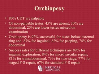 Orchiopexy
• 80% UDT are palpable
• Of non-palpable testes, 45% are absent, 30% are
abdominal, 25% are lower testes missed on
examination
• Orchiopexy is 92% successful for testes below external
ring and 87% for inguinal, 82% for peeping, 74% for
abdominal
• Success rates for different techniques are 89% for
inguinal exploration, 84% for microvascular repair,
81% for transabdominal, 73% for two-stage, 77% for
staged F-S repair, 67% for standard F-S repair
 