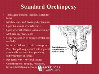 Standard Orchiopexy
• Transverse inguinal incision, watch for
testis
• Identify testis and divide gubernaculum
• Open tunics and evaluate testis
• Open external oblique fascia, avoid nerve
• Mobilize spermatic cord
• Finger dissection to enlarge scrotal cavity
medially
• Incise scrotal skin, create dartos pouch
• Pass clamp through pouch into inguinal
area and bring testis into pouch by
gubernaculum or tunica
• Pex testis with 4-0 vicryl sutures
• Complications: atrophy, retraction,
torsion, hematoma, nerve or vas injury
 