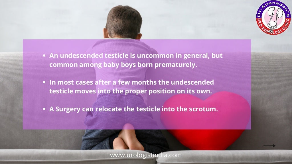 Undescended testicle symptoms and causes