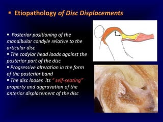 Undestanding tmj internal derangements 1 | PDF
