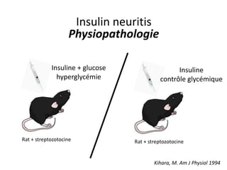Insulin neuritis
Physiopathologie
Insuline + glucose
hyperglycémie
Rat + streptozotocine
Kihara, M. Am J Physiol 1994
Insuline
contrôle glycémique
Rat + streptozotocine
 