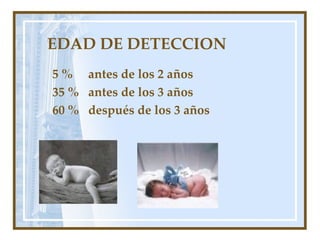 EDAD DE DETECCION 5 %  antes de los 2 años 35 %  antes de los 3 años 60 %  después de los 3 años 