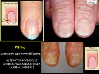 unghia-anatomia-clinica-pdf