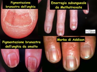 unghia-anatomia-clinica-pdf