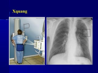Xquang
 
