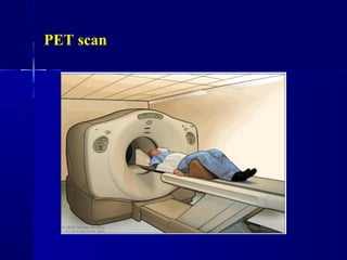 PET scan
 