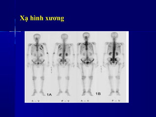 Xạ hình xương
 