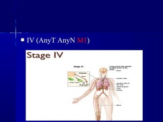  IV (AnyT AnyN M1)
 