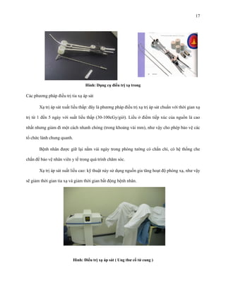 17

Hình: Dụng cụ điều trị xạ trong

Các phương pháp điều trị tia xạ áp sát
Xạ trị áp sát xuất liều thấp: đây là phương pháp điều trị xạ trị áp sát chuẩn với thời gian xạ
trị từ 1 đến 5 ngày với suất liều thấp (30-100cGy/giờ). Liều ở điểm tiếp xúc của nguồn là cao
nhất nhưng giảm đi một cách nhanh chóng (trong khoảng vài mm), như vậy cho phép bảo vệ các
tổ chức lành chung quanh.
Bệnh nhân được giữ lại nằm vài ngày trong phòng tường có chắn chì, có hệ thống che
chắn để bảo vệ nhân viên y tế trong quá trình chăm sóc.
Xạ trị áp sát suất liều cao: kỹ thuật này sử dụng nguồn gia tăng hoạt độ phóng xạ, như vậy
sẽ giảm thời gian tia xạ và giảm thời gian bất động bệnh nhân.

Hình: Điều trị xạ áp sát ( Ung thƣ cổ tử cung )

 