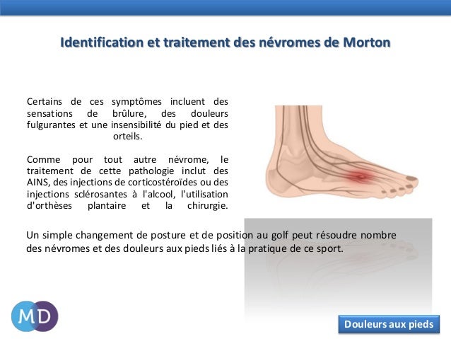 Lhémostasie et la thrombose le site