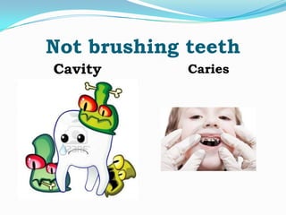 Not brushing teeth
Cavity

Caries

 