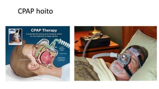 CPAP hoito
 