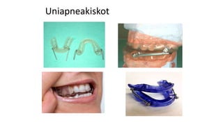 Uniapneakiskot
 