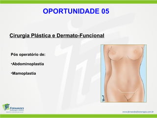 OPORTUNIDADE 05


Cirurgia Plástica e Dermato-Funcional


Pós operatório de:

•Abdominoplastia

•Mamoplastia
 