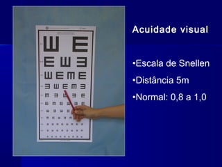 Acuidade visual
•Escala de Snellen
•Distância 5m
•Normal: 0,8 a 1,0
 
