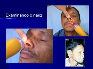 Examinando o nariz
 